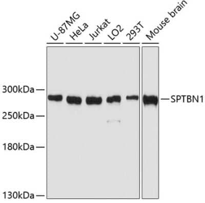 Western Blot: Spectrin beta 2 AntibodyAzide and BSA Free [NBP2-93443]